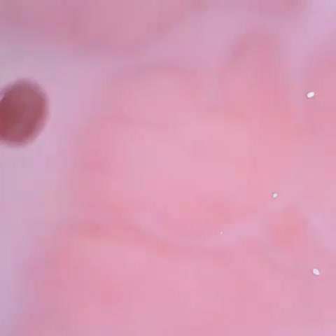 内窥镜阴道内壁嫩屄